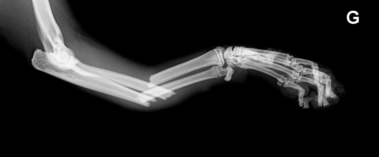 Traumatologie ostéo-articulaire - Champ du Roi La Clinique Vétérinaire ...